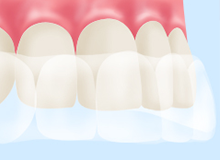のはら歯科クリニックの3DSアプローチ