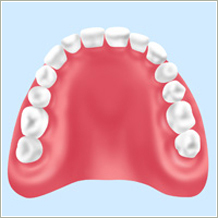 総入れ歯プラスチック