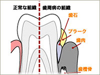 症状