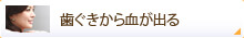 歯ぐきから血が出る